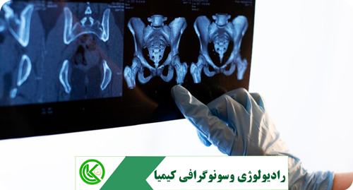 radiology-OPG-pacs